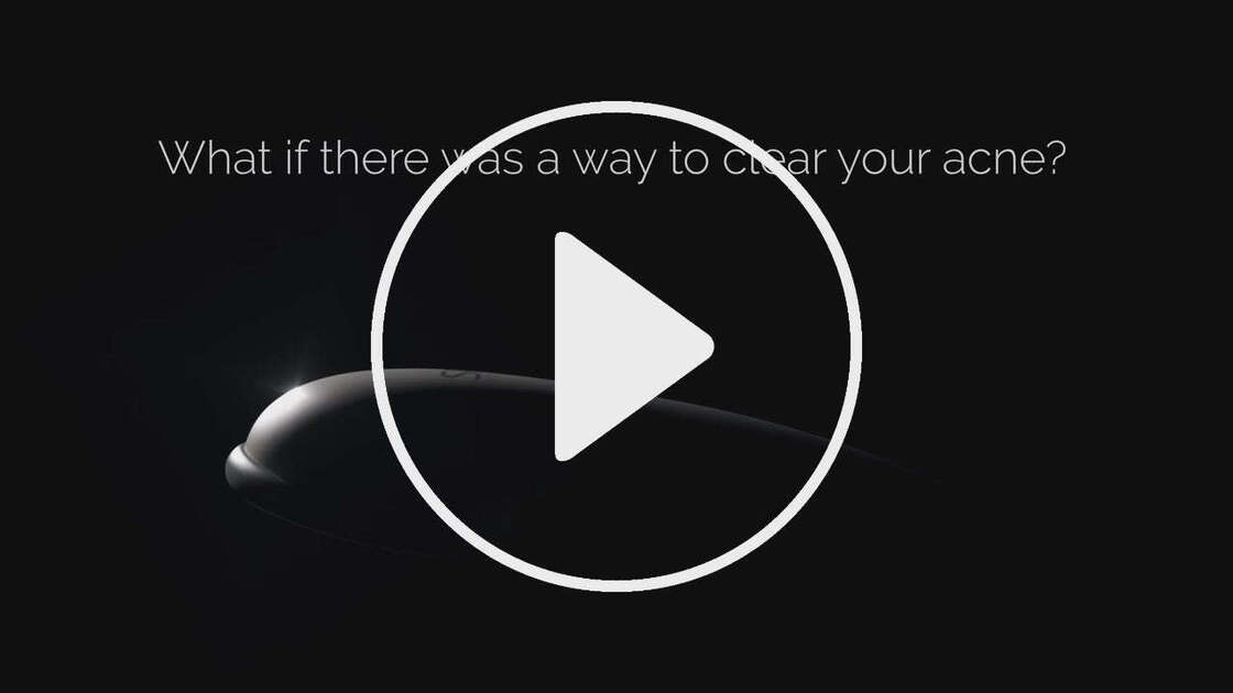 CLARO FDA Cleared Clinically Proven Acne Clearing Device with Blue and Red LED Light Therapy